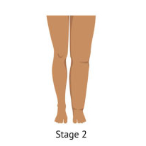 Northern Michigan Vein Specialists - Traverse City