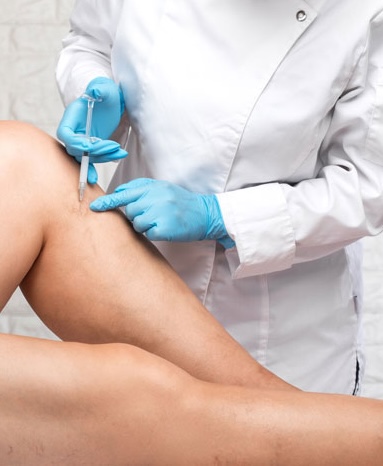 nmvs-sclerotherapy-in-michigan-cadillac-traverse-city